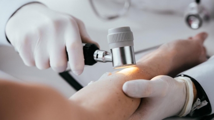 Revolutionary Psoriasis Patch: A Beauty Game-Changer?